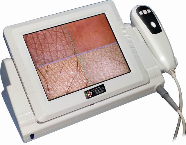 8寸液晶屏皮肤检测仪一体 皮肤测试仪 皮肤分析仪